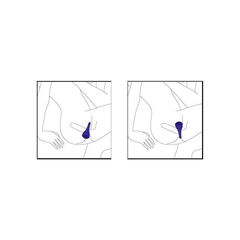 NALONE Anillo Vibrador Ping Fuchsia